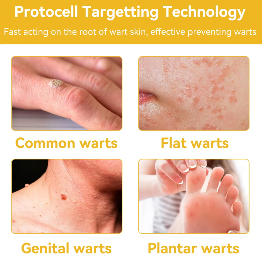 Bee Venom Treatment