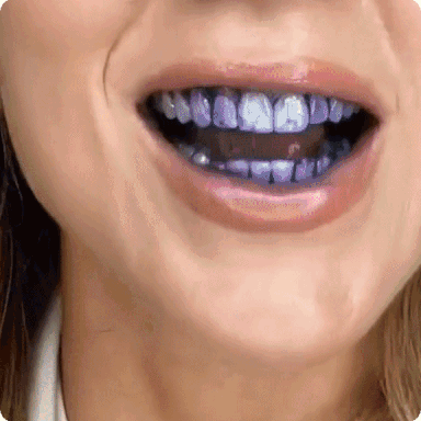 Hismile - Teeth Brightening Serum V34 (Original)